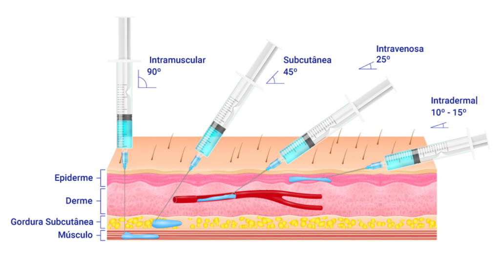 Etapa Pensar slogan melhor agulha para intramuscular retirar Especializado  Injusto